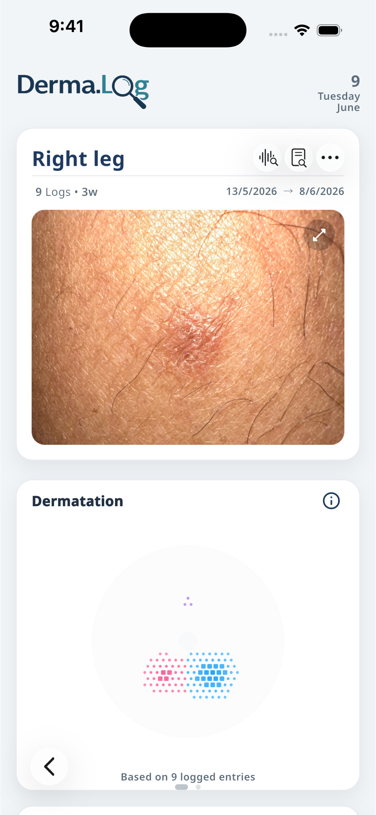 Derma.Log spot record screen with image history and observation summary