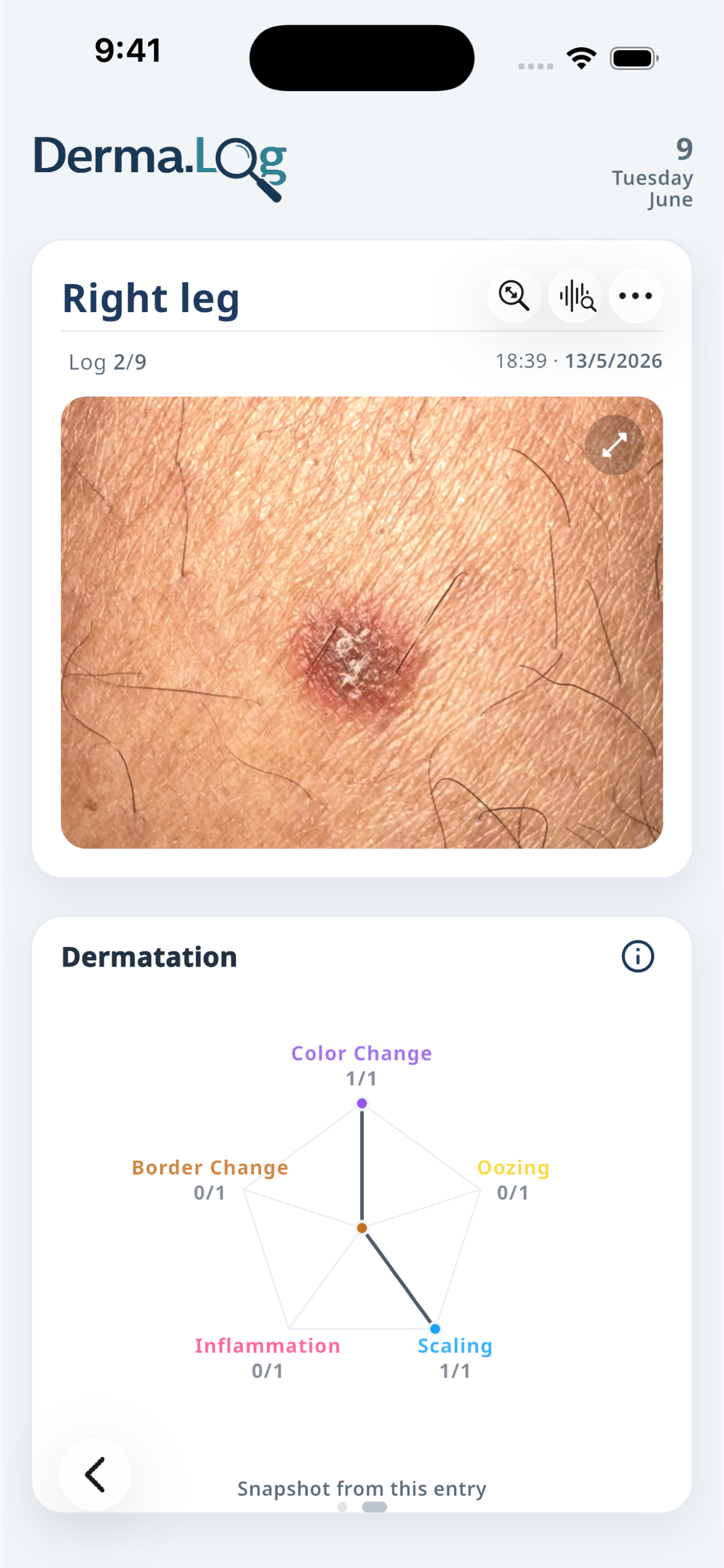 Derma.Log log entry screen showing a saved image and observation summary