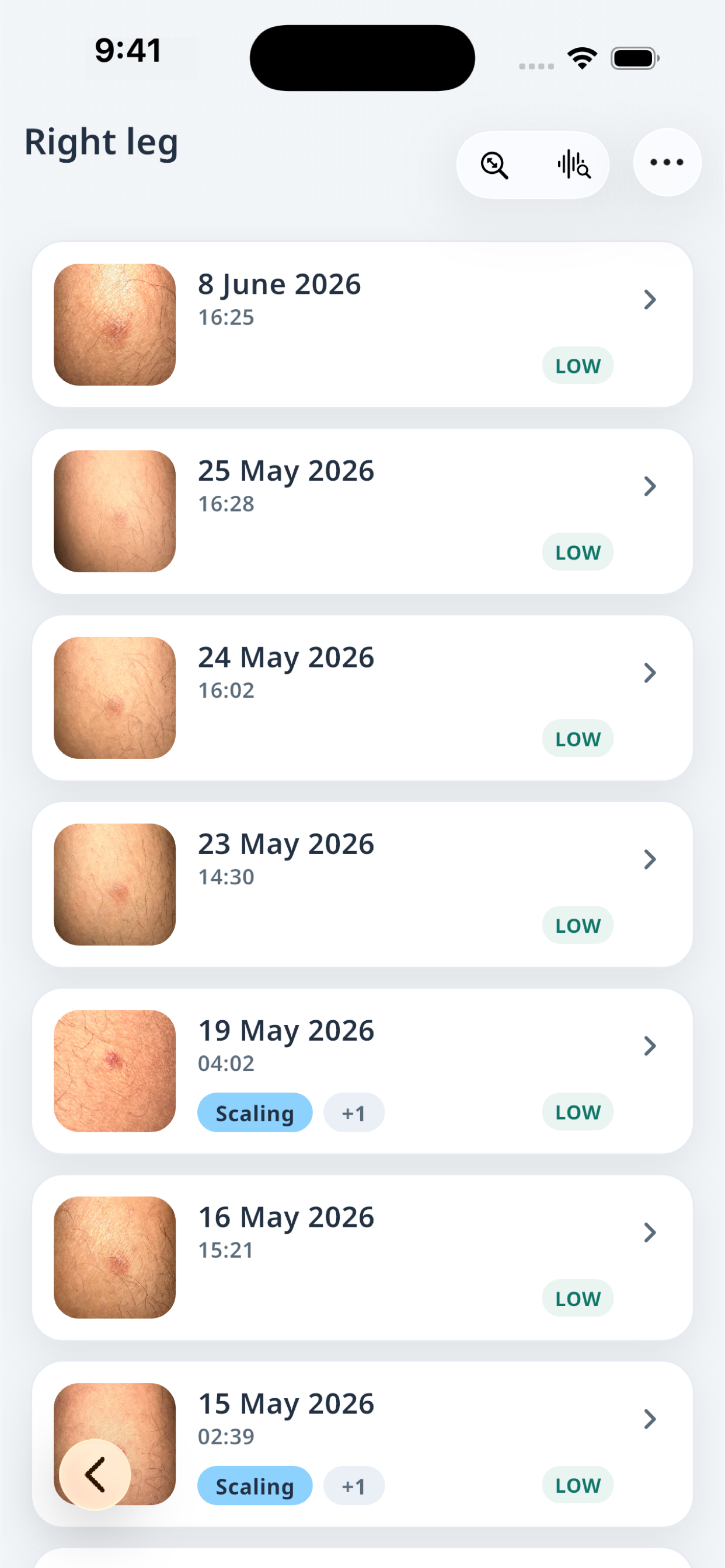Derma.Log timeline screen listing entries for one skin record