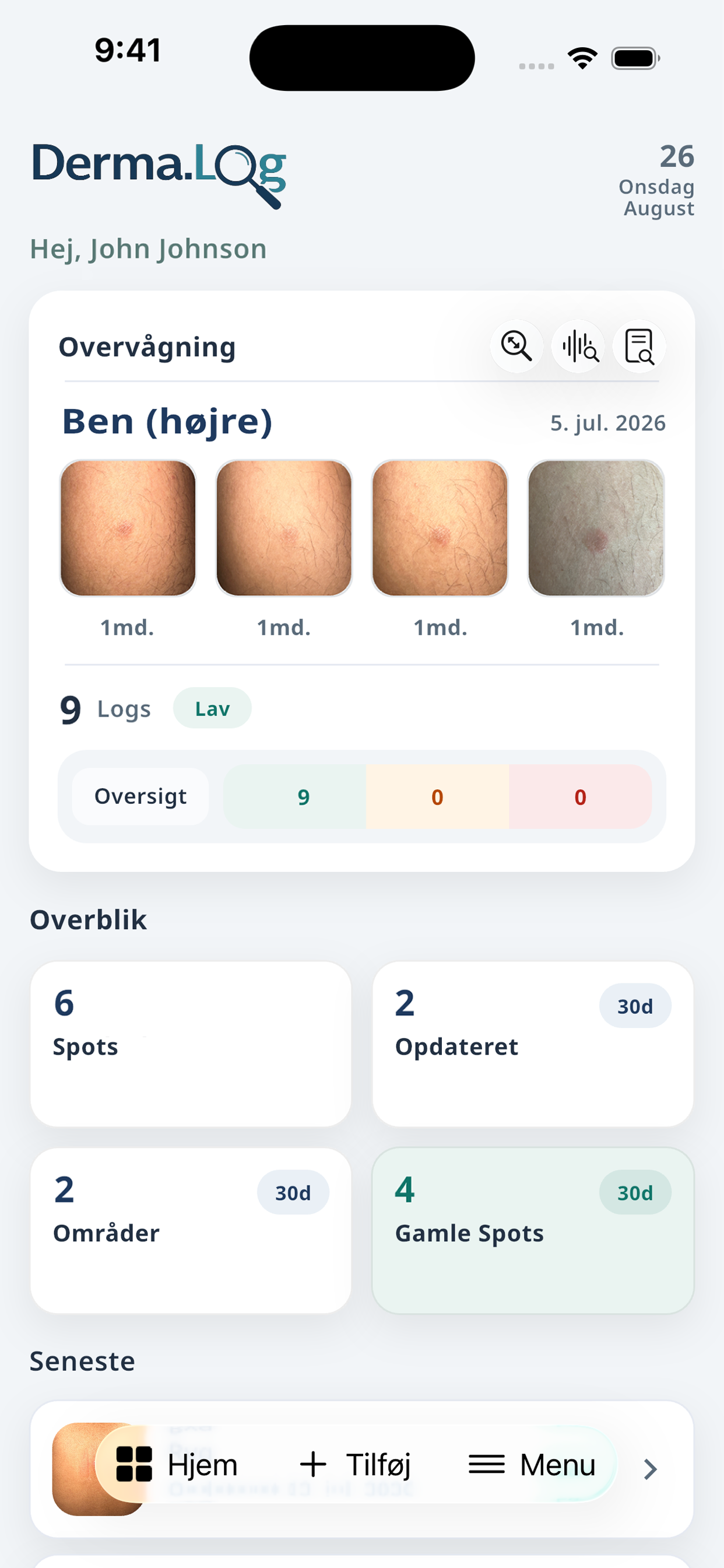 Derma.Log-dashboard med grupperede Spots, billedhistorik og overblik