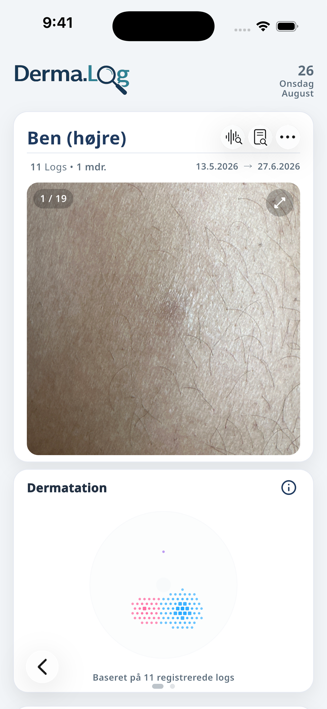Derma.Log Spot-visning med billedhistorik og struktureret oversigt