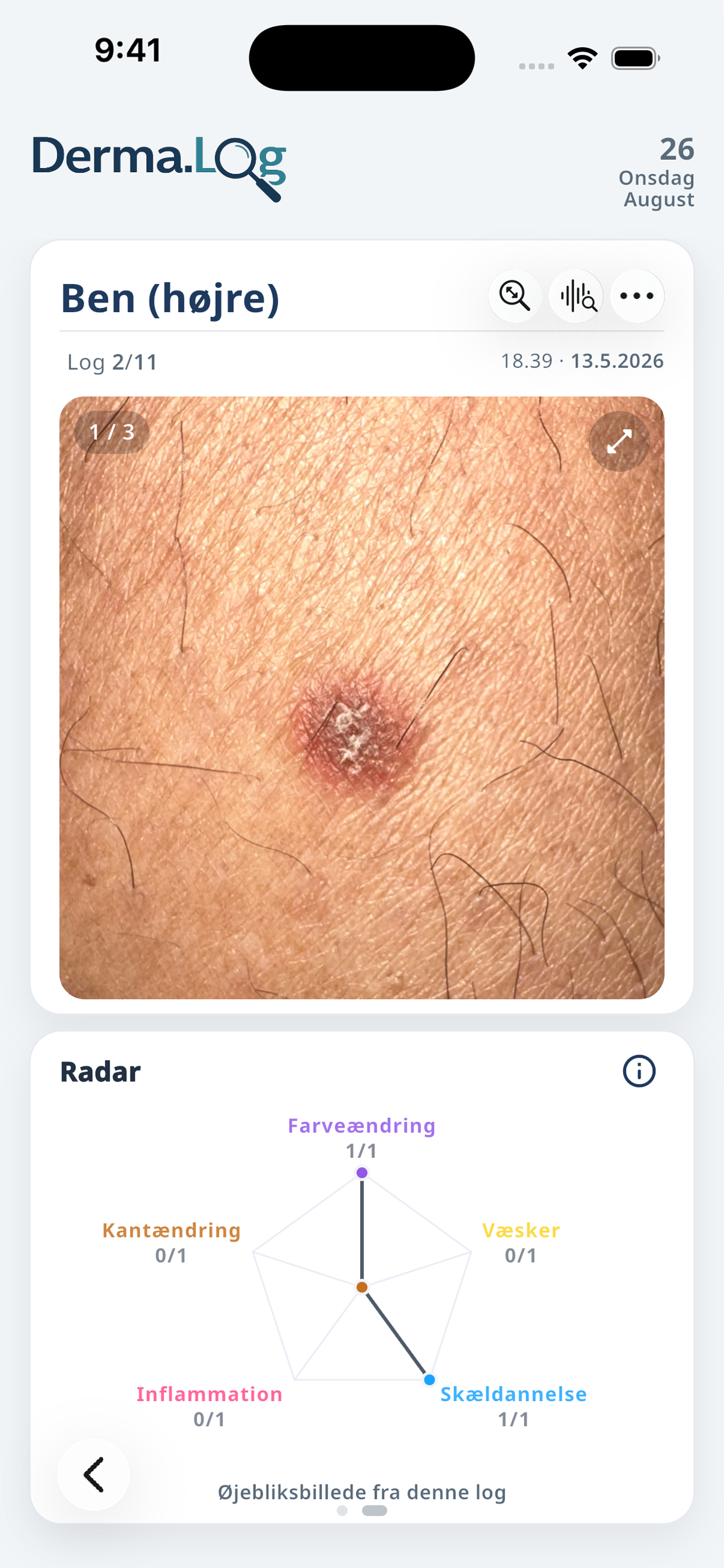 Derma.Log logvisning med gemt billede og registrerede observationssignaler