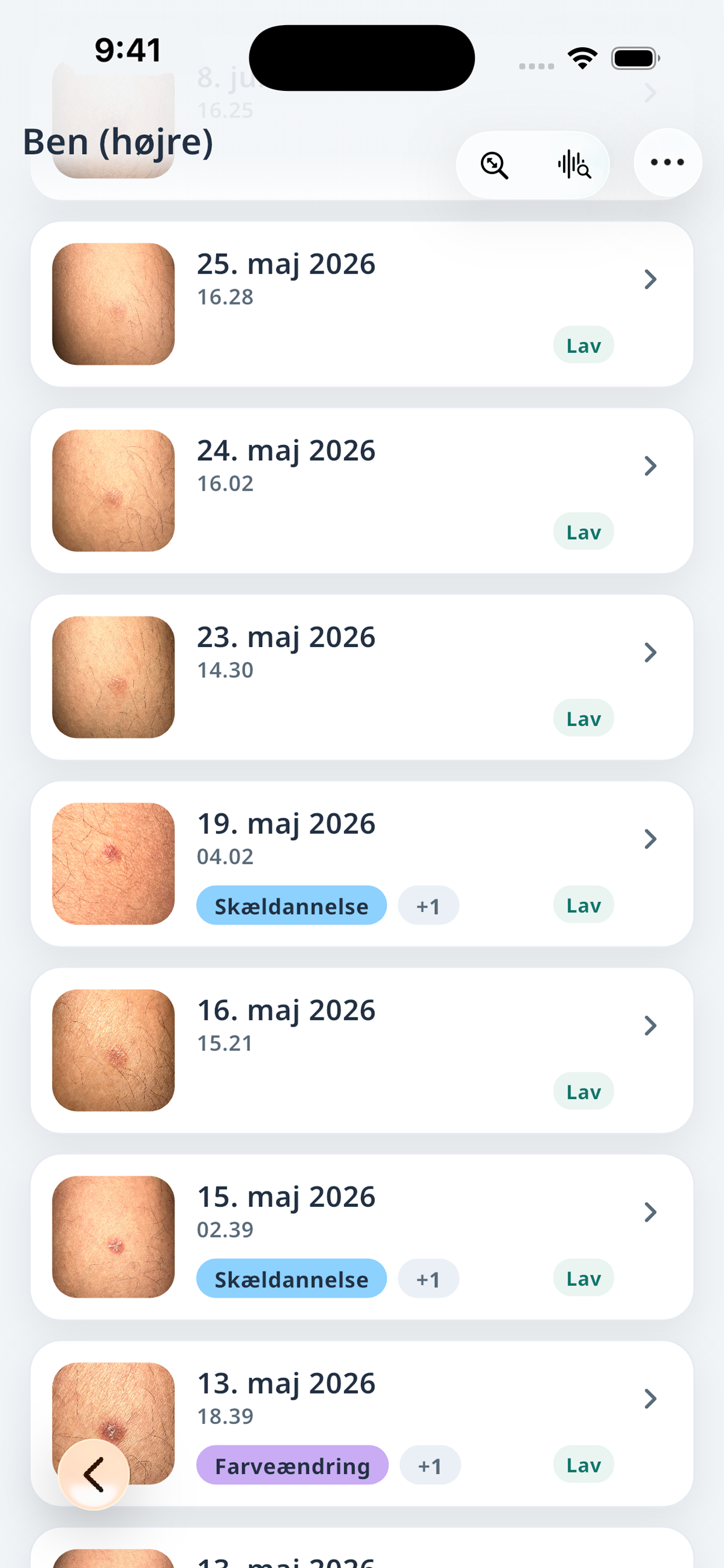 Derma.Log-historik med kronologiske logge for et Spot